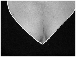 Lice pour les jeux du délice Poitrine